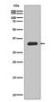 Cyclin Dependent Kinase Inhibitor 1B antibody, M00173-1, Boster Biological Technology, Western Blot image 