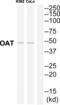 Ornithine aminotransferase, mitochondrial antibody, abx014687, Abbexa, Western Blot image 