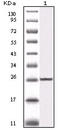 Inhibitor Of Nuclear Factor Kappa B Kinase Subunit Beta antibody, M00118-2, Boster Biological Technology, Western Blot image 