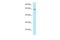 HAUS Augmin Like Complex Subunit 1 antibody, A14899, Boster Biological Technology, Western Blot image 