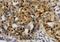 ETS Proto-Oncogene 1, Transcription Factor antibody, A00931-3, Boster Biological Technology, Immunohistochemistry paraffin image 