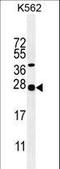 Galanin And GMAP Prepropeptide antibody, LS-B10779, Lifespan Biosciences, Western Blot image 