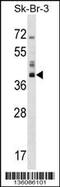 Hydroxysteroid 17-Beta Dehydrogenase 1 antibody, 58-560, ProSci, Western Blot image 