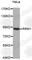 Ribonucleotide Reductase Catalytic Subunit M1 antibody, A0599, ABclonal Technology, Western Blot image 