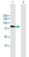 RecQ Like Helicase 4 antibody, H00009401-B01P, Novus Biologicals, Western Blot image 