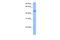 Upstream Binding Transcription Factor Like 1 antibody, A18989, Boster Biological Technology, Western Blot image 