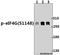 Eukaryotic Translation Initiation Factor 4 Gamma 1 antibody, A01351S1148, Boster Biological Technology, Western Blot image 