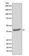 Cyclin Dependent Kinase 7 antibody, M00552, Boster Biological Technology, Western Blot image 