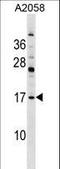 Phosphodiesterase 6D antibody, LS-C158561, Lifespan Biosciences, Western Blot image 
