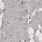CD142 antibody, NBP2-61641, Novus Biologicals, Immunohistochemistry paraffin image 
