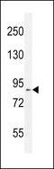DEAD/H-Box Helicase 11 antibody, 55-186, ProSci, Western Blot image 