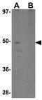Rhomboid Domain Containing 1 antibody, GTX31979, GeneTex, Western Blot image 