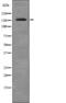 c-met antibody, abx216808, Abbexa, Western Blot image 