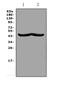 Chitinase 3 Like 1 antibody, A01283-1, Boster Biological Technology, Western Blot image 