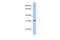 Extracellular Leucine Rich Repeat And Fibronectin Type III Domain Containing 2 antibody, GTX45897, GeneTex, Western Blot image 