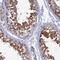 Steroid Receptor RNA Activator 1 antibody, HPA044598, Atlas Antibodies, Immunohistochemistry paraffin image 