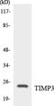 TIMP Metallopeptidase Inhibitor 3 antibody, LS-C200786, Lifespan Biosciences, Western Blot image 