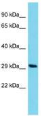 Coiled-Coil Domain Containing 198 antibody, TA330668, Origene, Western Blot image 