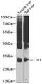 Cerberus 1, DAN Family BMP Antagonist antibody, 22-887, ProSci, Western Blot image 