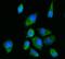 Ribosomal Protein S2 antibody, A03548-3, Boster Biological Technology, Immunofluorescence image 
