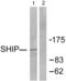 Inositol Polyphosphate-5-Phosphatase D antibody, abx013191, Abbexa, Western Blot image 