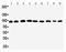 Plakophilin-2 antibody, PA2278, Boster Biological Technology, Western Blot image 