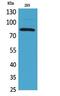 Minichromosome Maintenance Complex Component 7 antibody, A01649-1, Boster Biological Technology, Western Blot image 