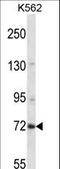 Zinc Finger Protein 132 antibody, LS-C160823, Lifespan Biosciences, Western Blot image 