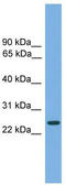 Charged Multivesicular Body Protein 4B antibody, TA337561, Origene, Western Blot image 