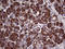 SEC23 Homolog B, Coat Complex II Component antibody, LS-C792367, Lifespan Biosciences, Immunohistochemistry paraffin image 