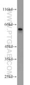 Beta-Carotene Oxygenase 2 antibody, 14324-1-AP, Proteintech Group, Western Blot image 