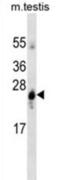 Glutathione S-transferase A1 antibody, abx025297, Abbexa, Western Blot image 