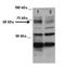 Tyrosyl-DNA Phosphodiesterase 1 antibody, NBP1-74175, Novus Biologicals, Western Blot image 