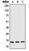 Retinoic Acid Receptor Responder 2 antibody, MBS822313, MyBioSource, Western Blot image 