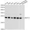 NOP16 Nucleolar Protein antibody, LS-C749138, Lifespan Biosciences, Western Blot image 