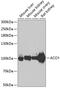 Aconitase 1 antibody, 19-974, ProSci, Western Blot image 
