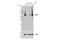 Solute Carrier Family 17 Member 6 antibody, 71555S, Cell Signaling Technology, Western Blot image 