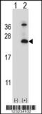 Tetraspanin 6 antibody, 63-845, ProSci, Western Blot image 