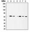 Histone Deacetylase 1 antibody, LS-C352326, Lifespan Biosciences, Western Blot image 