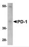 Programmed Cell Death 1 antibody, PM-5179, ProSci, Western Blot image 