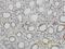 DNA topoisomerase 1 antibody, H00007150-M01, Novus Biologicals, Immunohistochemistry paraffin image 
