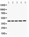 Actin Gamma 1 antibody, PA1324, Boster Biological Technology, Immunohistochemistry paraffin image 