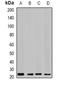 Cilia And Flagella Associated Protein 20 antibody, orb341240, Biorbyt, Western Blot image 