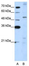Zinc Finger Protein 596 antibody, TA345594, Origene, Western Blot image 