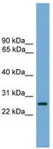 Leucine Rich Repeat Containing 3 antibody, TA338946, Origene, Western Blot image 