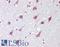 Zinc Finger MYM-Type Containing 3 antibody, LS-B7028, Lifespan Biosciences, Immunohistochemistry paraffin image 