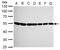 Tubulin Beta 8 Class VIII antibody, TA309065, Origene, Western Blot image 