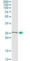 Twist-related protein 2 antibody, H00117581-M06, Novus Biologicals, Immunoprecipitation image 