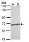 Zinc Finger Protein 223 antibody, NBP1-33094, Novus Biologicals, Western Blot image 