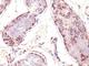 MAGE Family Member A1 antibody, NBP2-44507, Novus Biologicals, Immunohistochemistry frozen image 